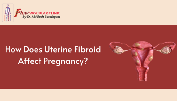 Can Fibroids Affect Pregnancy? The Shocking Truth