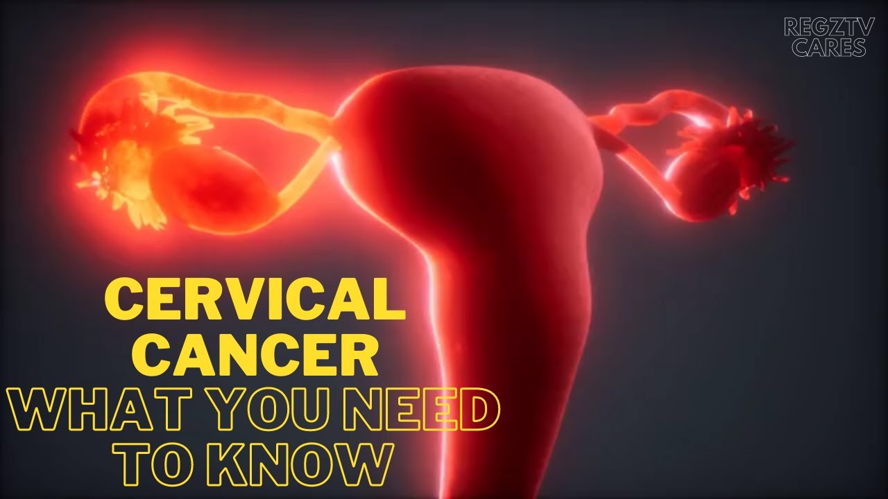 Unbelievable Cervical Cancer Risks — Even If You’re “Healthy”