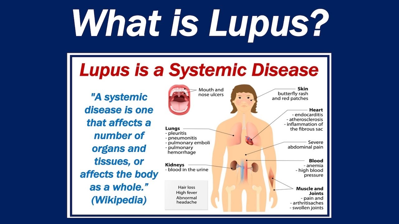 Hidden Lifestyle Triggers That Could Make Lupus Worse