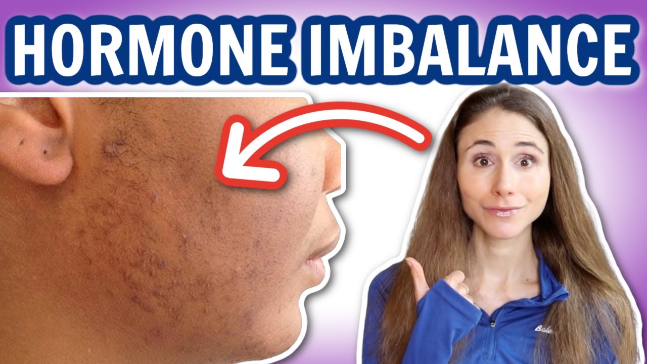 Unbelievable Hormone Imbalance Signs Showing Up on Your Face