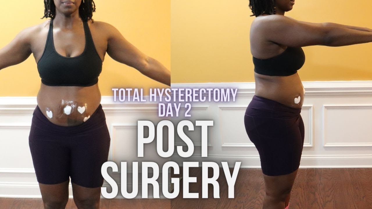 Hysterectomy Recovery Timeline: The Painful Truth About Healing