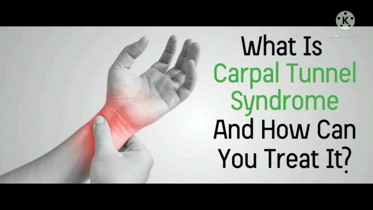 Ignoring Carpal Tunnel Syndrome for 90 Days Can Weaken Your Hands