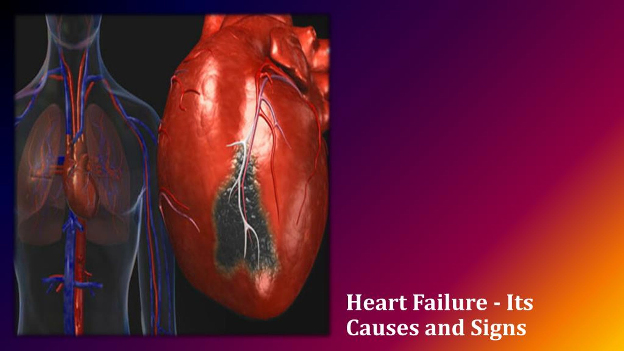 Understanding Heart Failure: Key Symptoms, Causes, and Effective Treatment Options