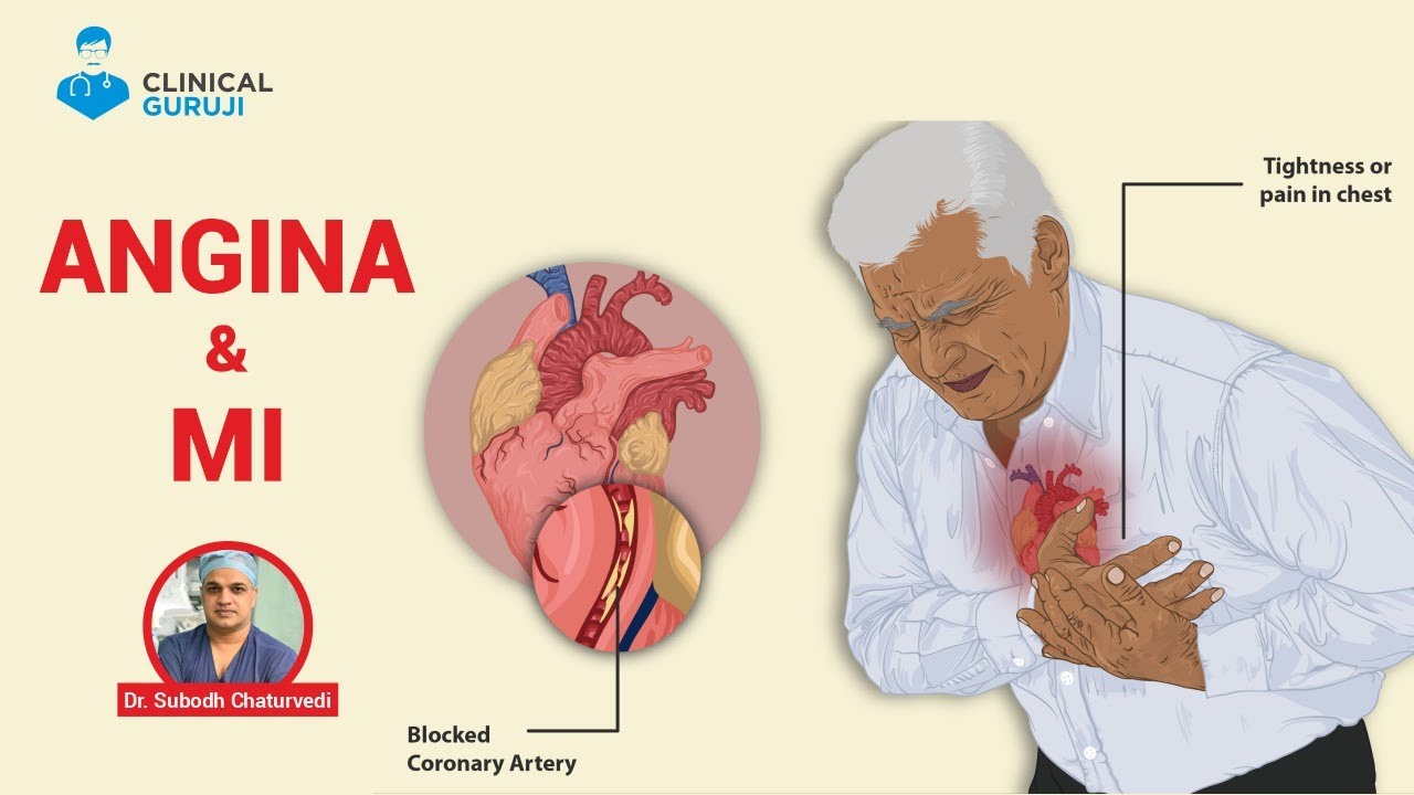 Early Angina Warning Signs Most People Ignore — Revealed