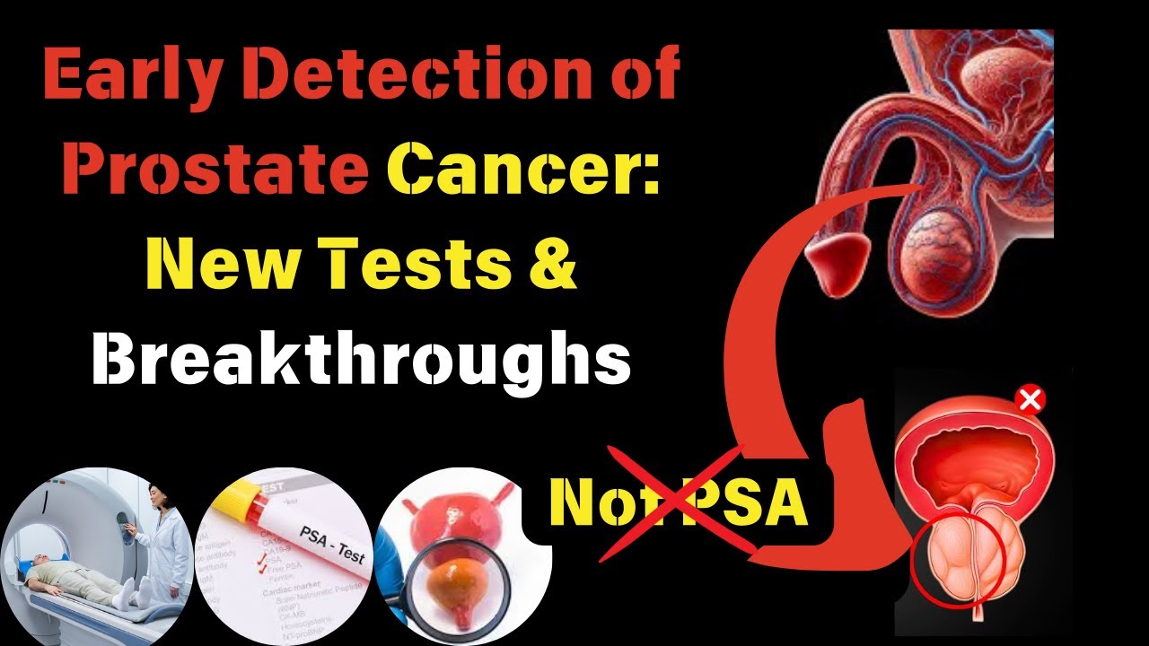 Prostate Cancer Tests May Fail — Here’s Why