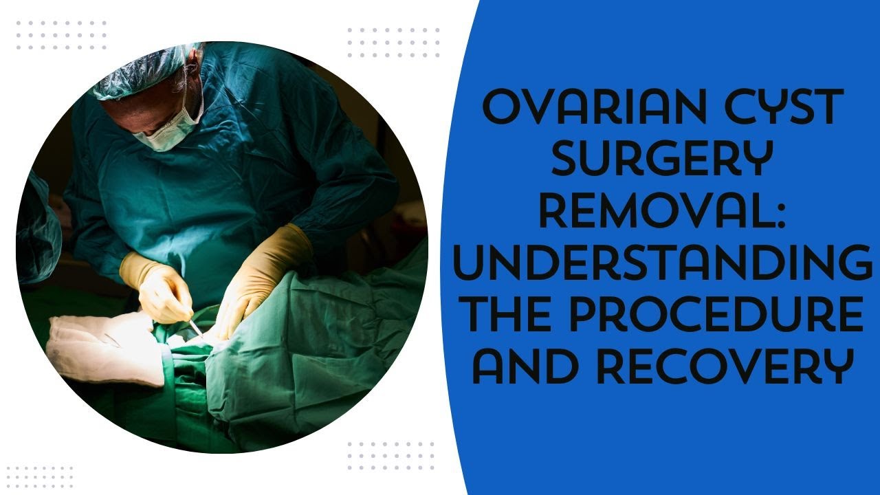 ovarian Cyst Surgery: The Real Recovery, Cost & Fertility Truth